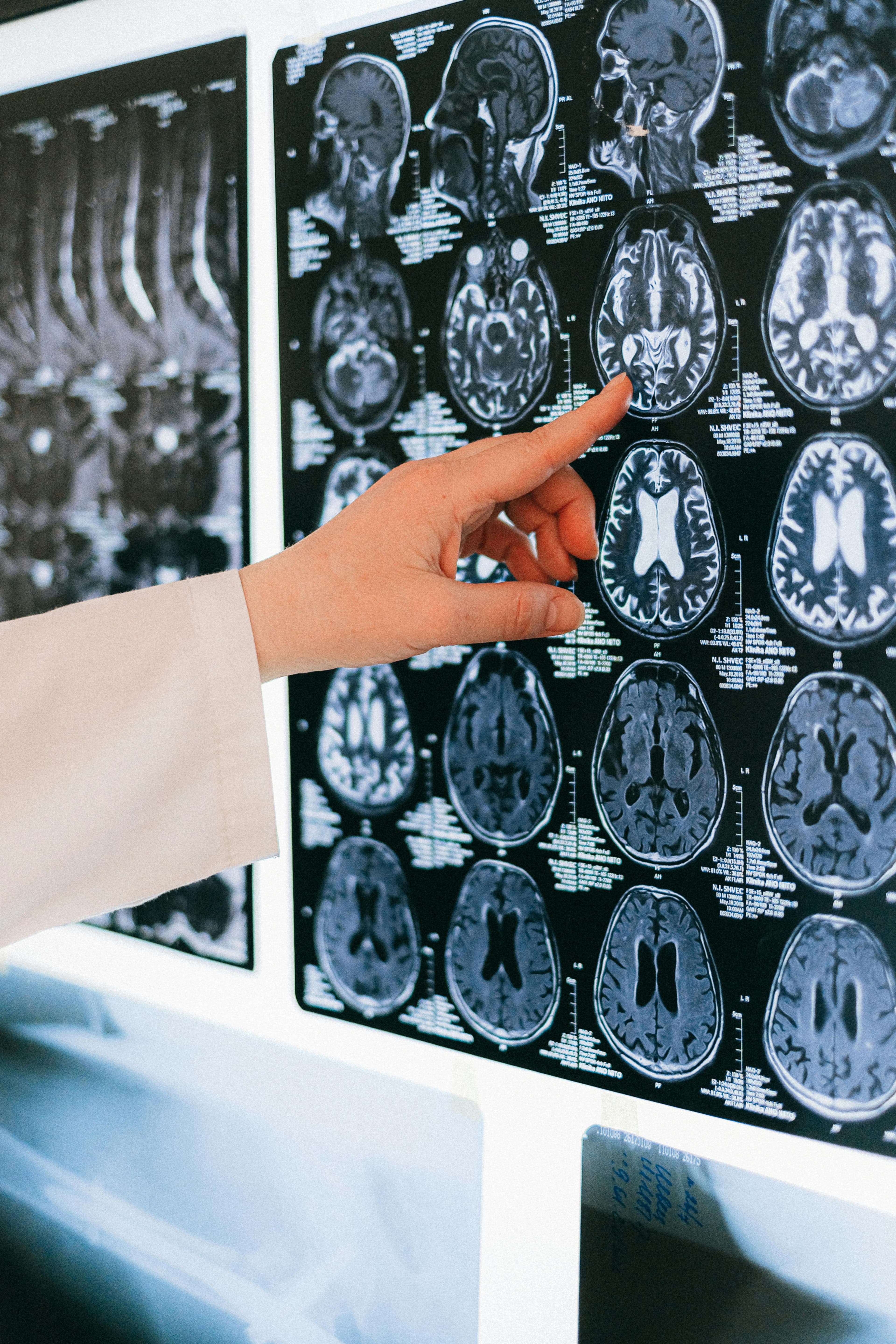 Medical Imaging (1 Year) MSc - Uni4edu